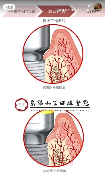 口腔小知識