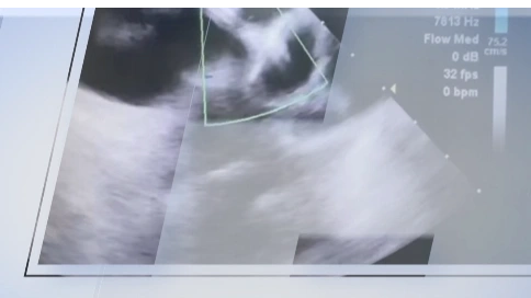 房颤中心宣传片视频