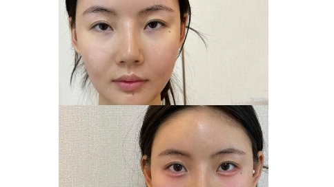 医美作品展示