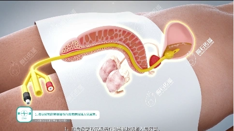 医疗器械动画：演示操作流程