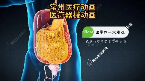 常州醫療動畫實力打造：手術流程動畫，助力教學培訓