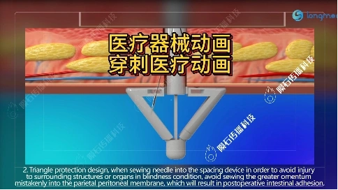 医疗器械动画：皮肤缝合器手术使用教程
