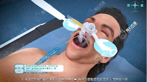 气管插管固定架推广必备：专业医疗三维动画方案