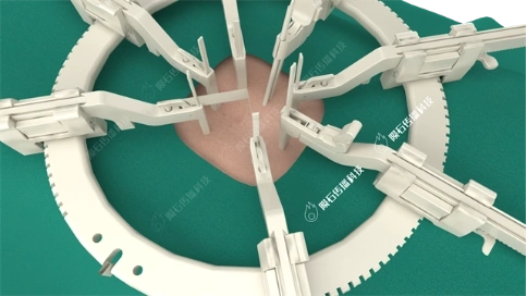 脊椎手术动画  3D 可视化技术，让医疗科普不枯燥！