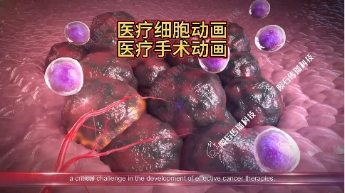 广州医疗手术动画：手术步骤可视化，医生培训好帮手